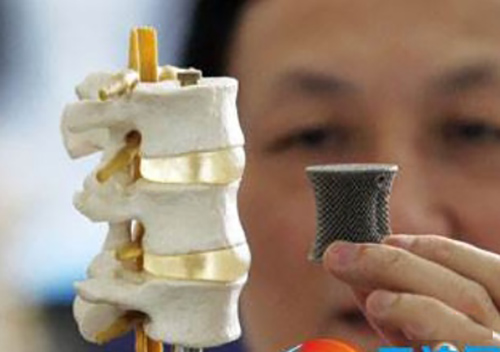 碳纖維骨科醫(yī)療應(yīng)用有哪些？