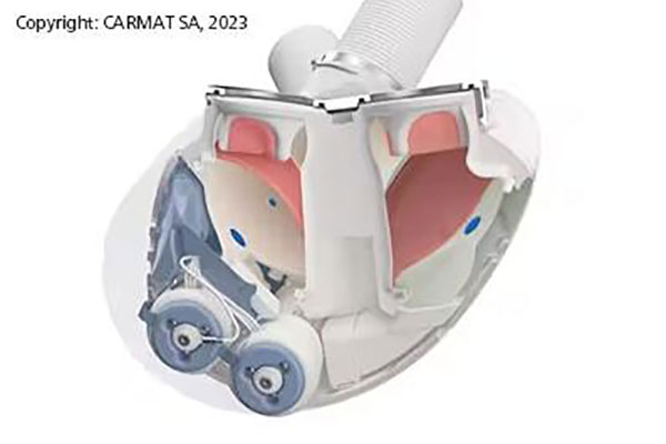 5項使用PEEK聚合物的驚人發(fā)明